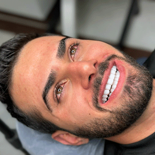 کامپوزیت دندان