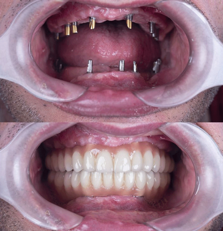 before & after